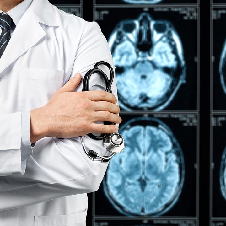Показания МРТ сосудов головного мозга