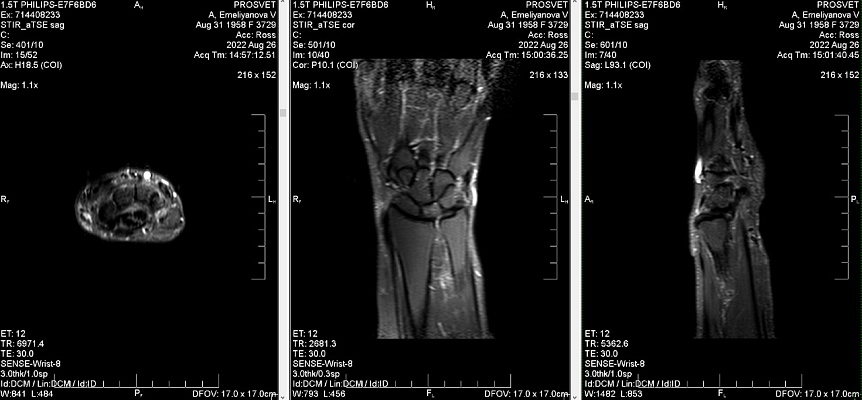 Как выглядят снимки МРТ суставов