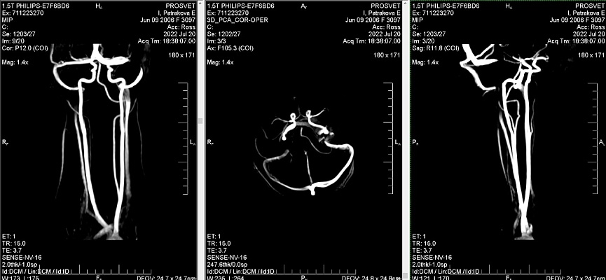 Как выглядят снимки МРТ сосудов шеи