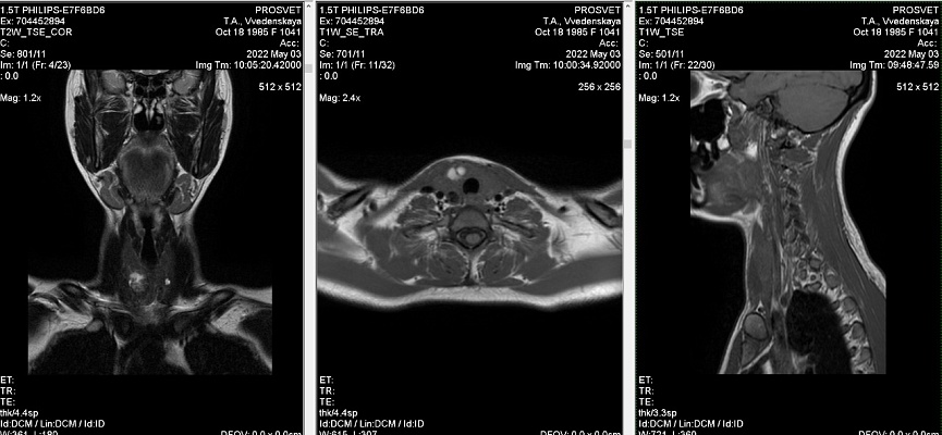 Как выглядят снимки МРТ мягких тканей